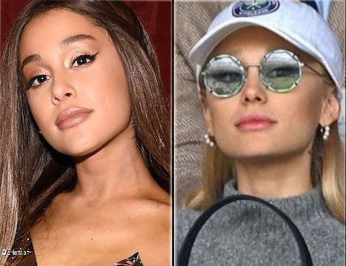 Ariana Grande Avant-Après les injections Ariana Grande Avant-Après les injections